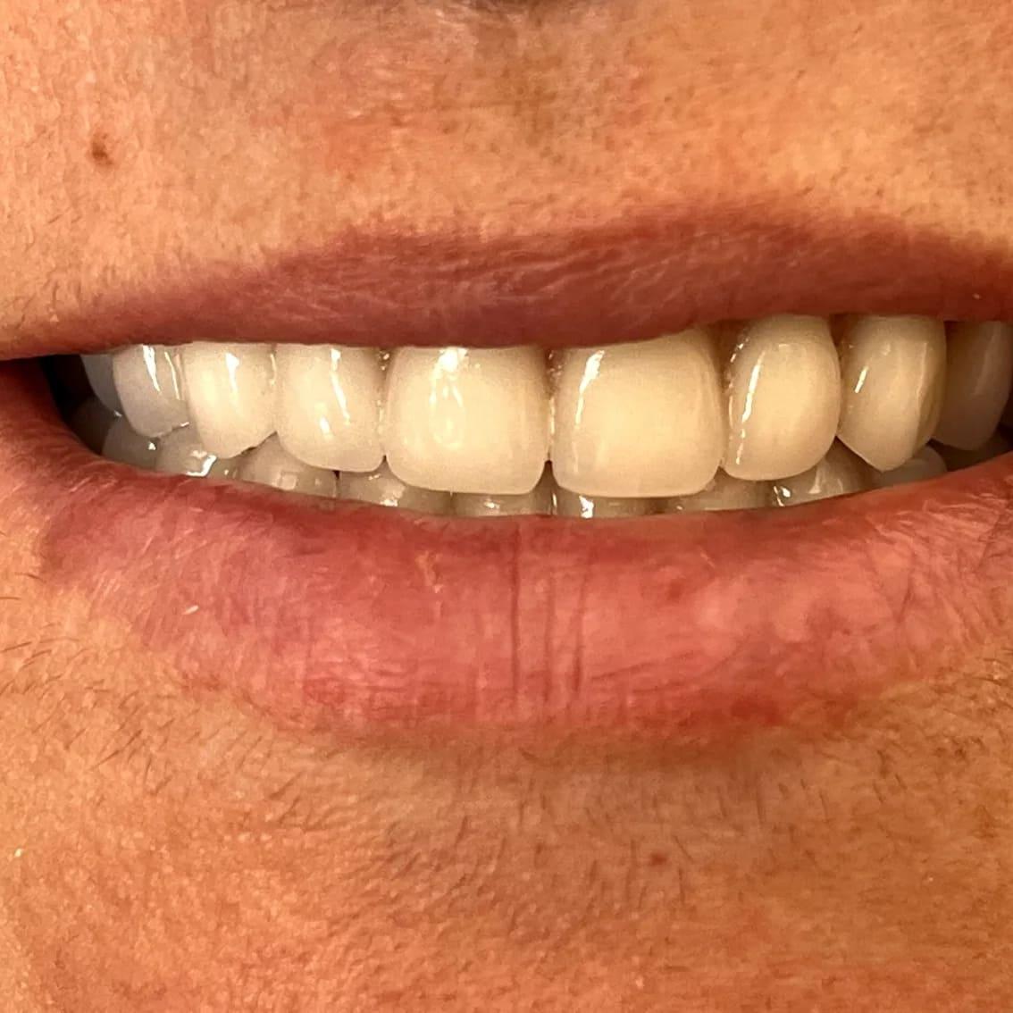 عکس لابراتوار دندانسازی نوین