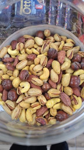 عکس هایپر حسینی