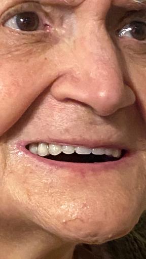 عکس دندانسازی مهدی 