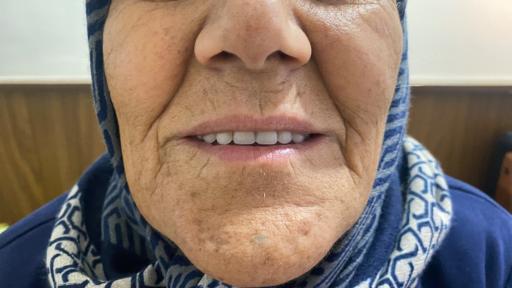 عکس دندانسازی مهدی 