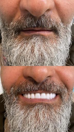 عکس دندانسازی مهدی 