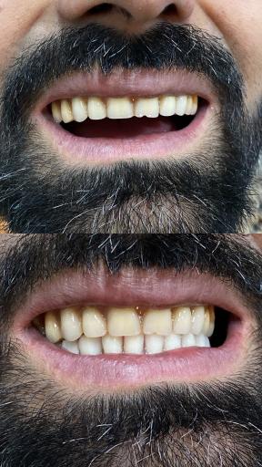 عکس دندانسازی مهدی 