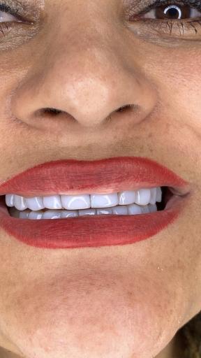 عکس دندانسازی مهدی 