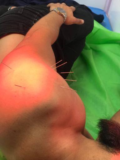 عکس فیزیوتراپی مهرا 