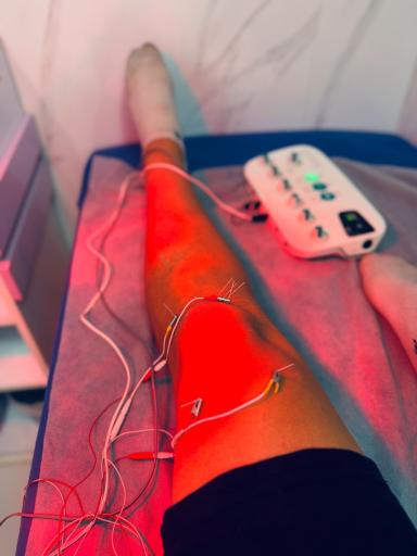 فیزیوتراپی مهرا 