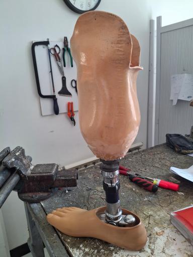 عکس کلینیک اسکن کف پا تندرست