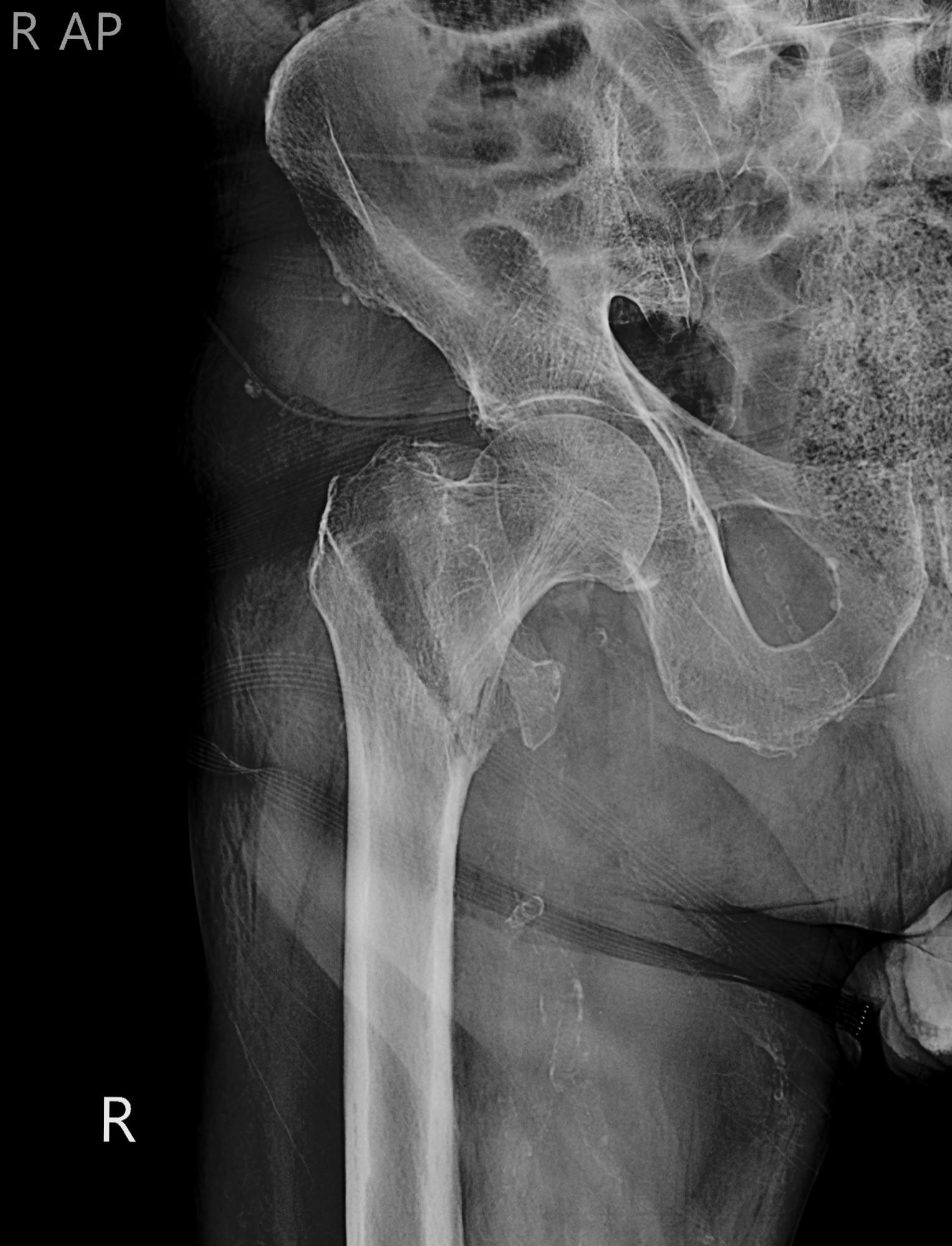 عکس رادیولوژی در منزل پارس پرتو