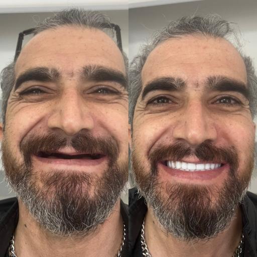 عکس دندانسازی محلات (فتح المبین)