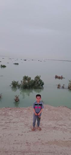 عکس ادیمی