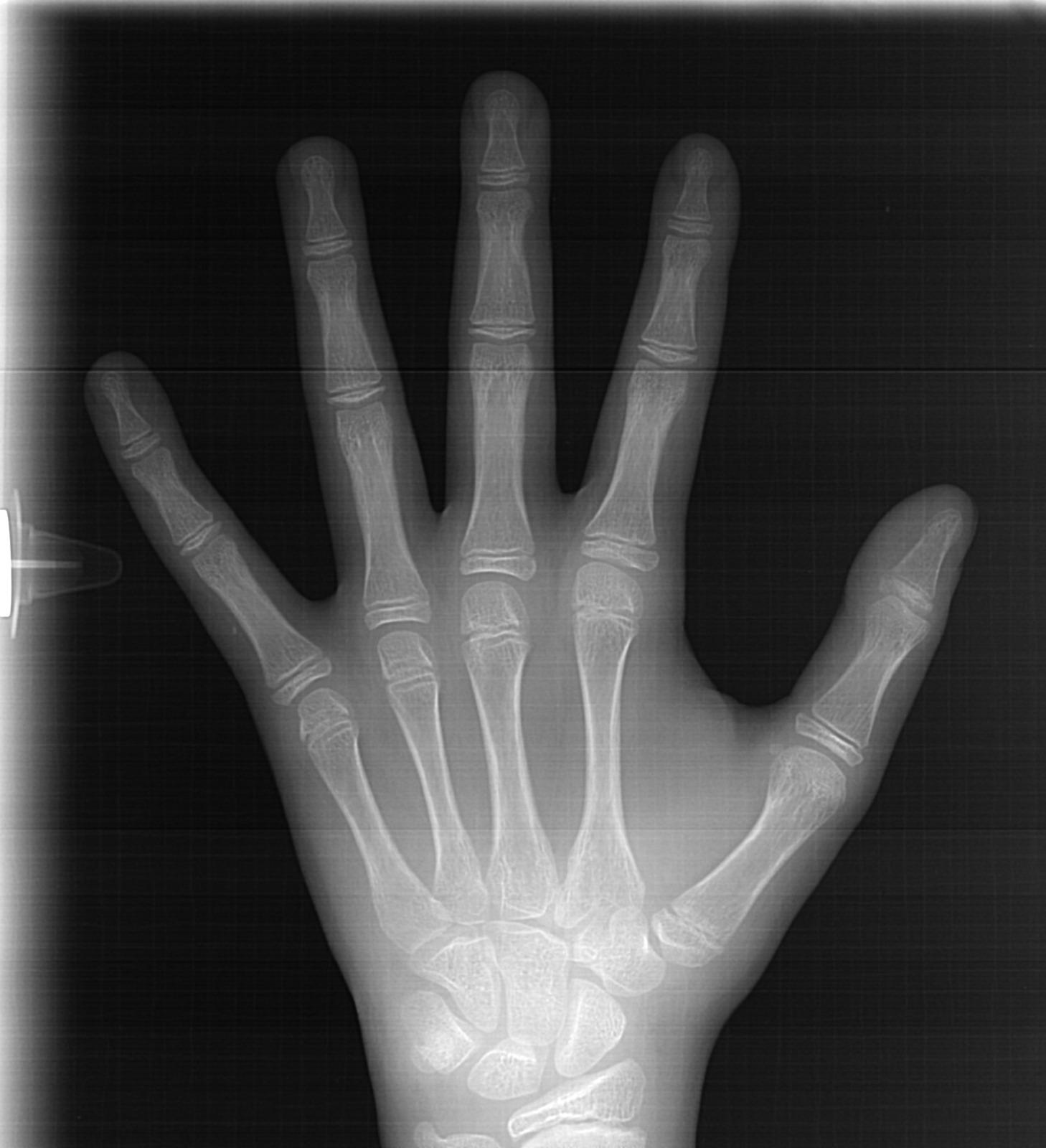 عکس رادیولوژی دهان و فک و صورت دکتر مریم منوچهری