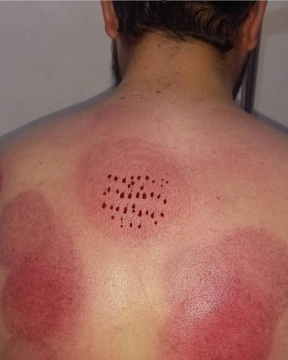 عکس مرکز حجامت تخصصی یاسوج مطب و گیاه درمانی طب الرضا (ع)