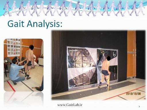 عکس آزمایشگاه آنالیز راه رفتن کوثر