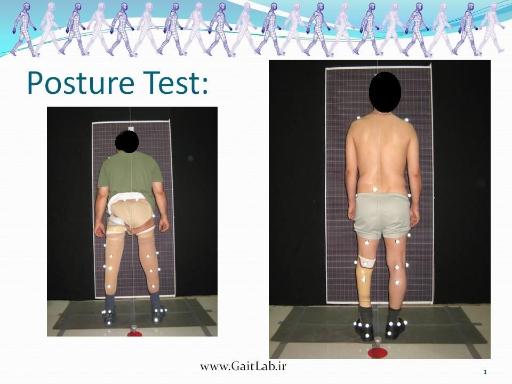 عکس آزمایشگاه آنالیز راه رفتن کوثر