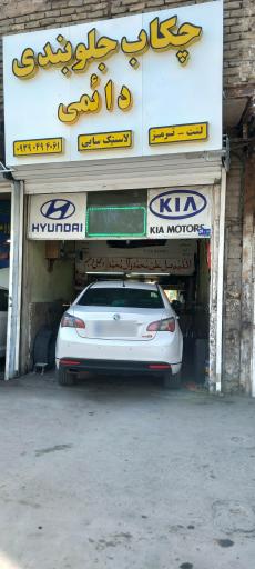 عکس جلوبندی دائمی