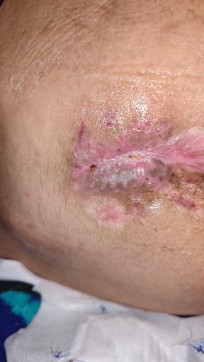 عکس کلینیک تخصصی زخم نوین