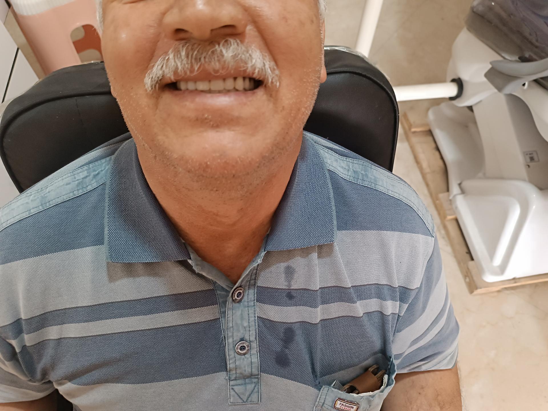 عکس دندانسازی پیر هادی