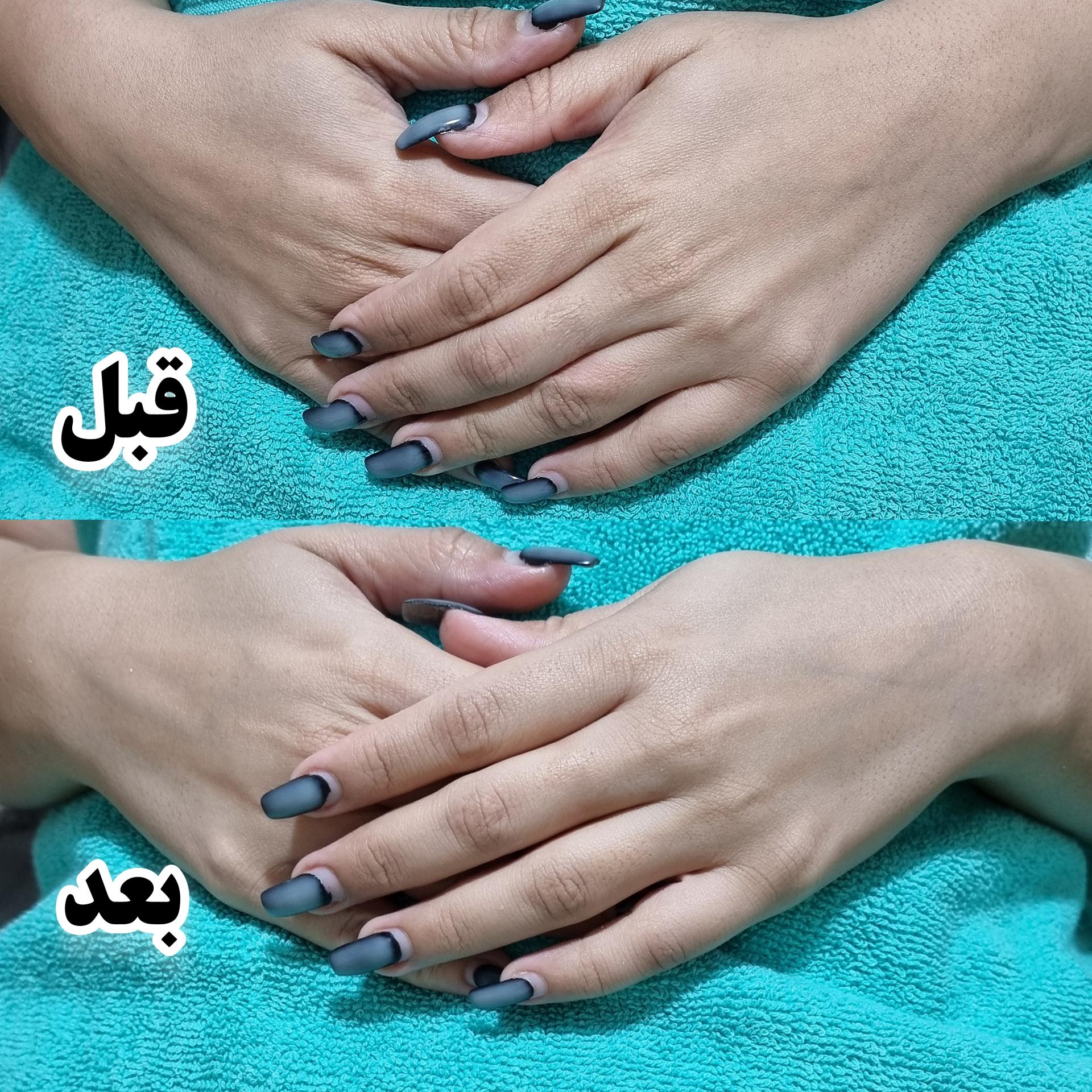 عکس مرکز فیشال و پاکسازی پوست تینا