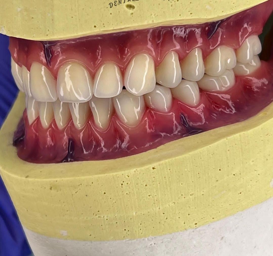 عکس دندانسازی صدف