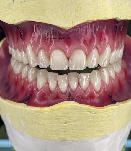 عکس دندانسازی صدف