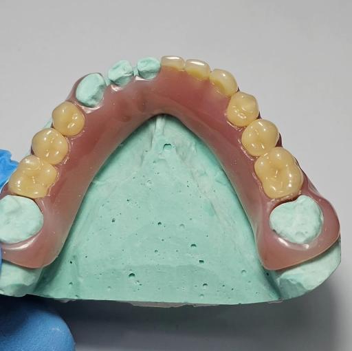 عکس دندانسازی صدف