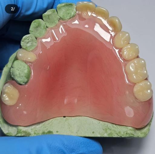 عکس دندانسازی صدف