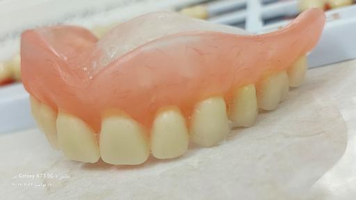 عکس دندانسازی صدف