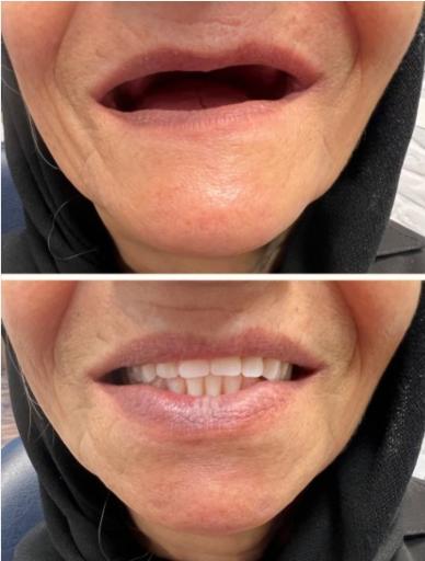 عکس دندانسازی پارس