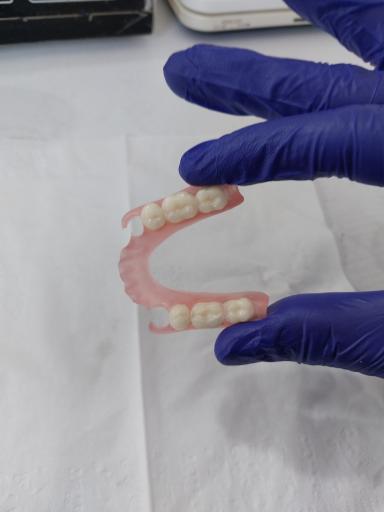 عکس دندانسازی آوا