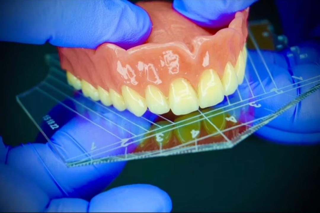 عکس دندانسازی آوا