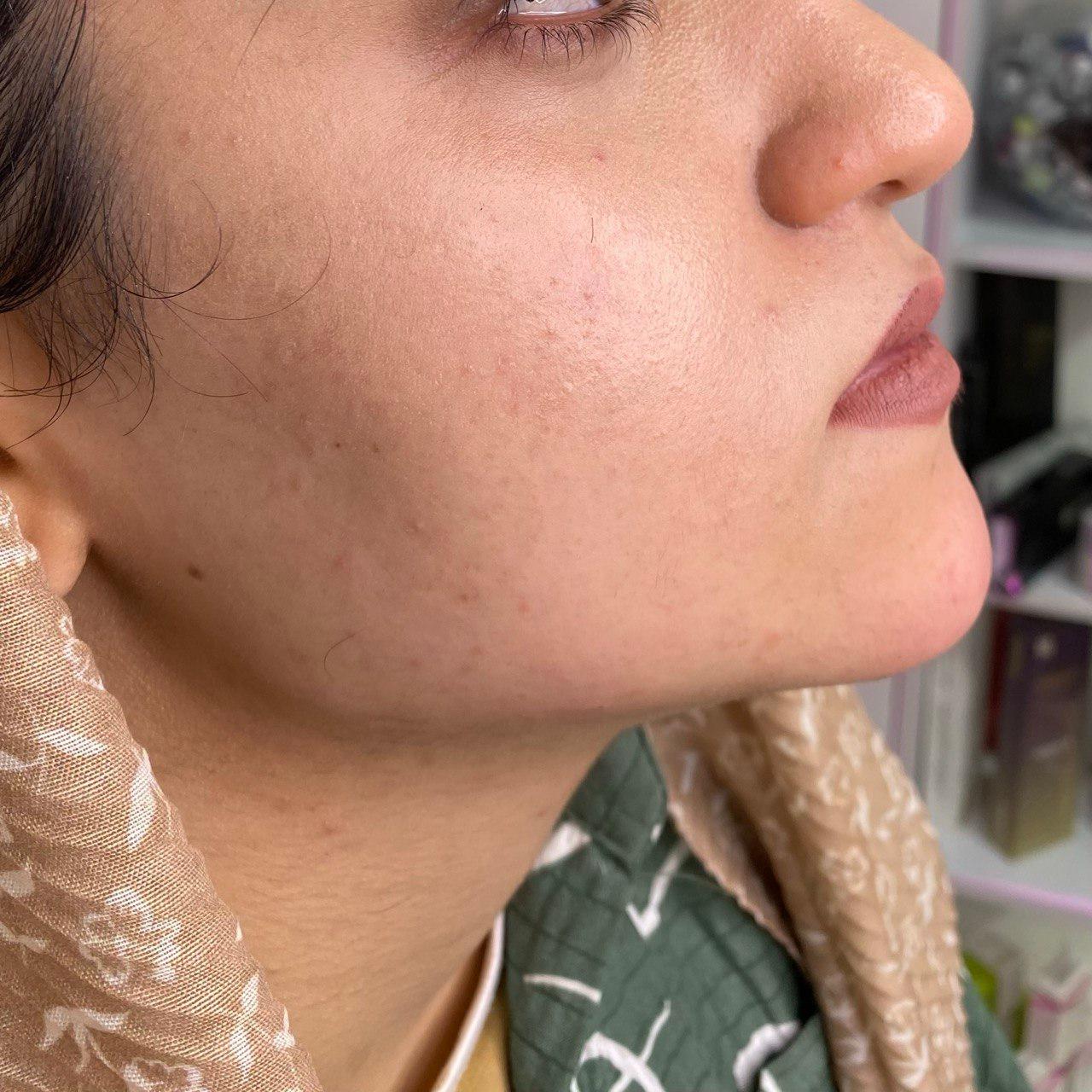 عکس کلینیک لیزر و زیبایی رویال بیوتی