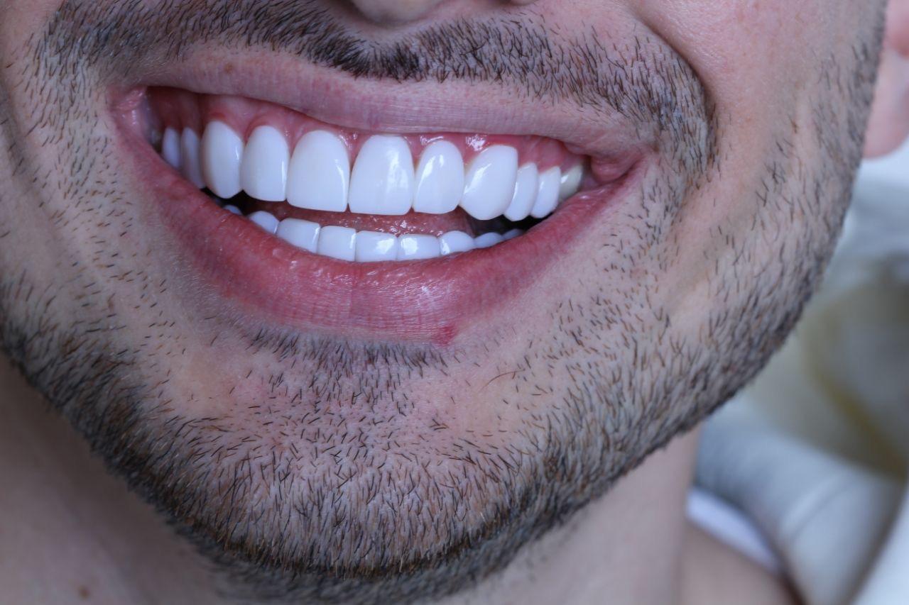 عکس دندان پزشکی حامی