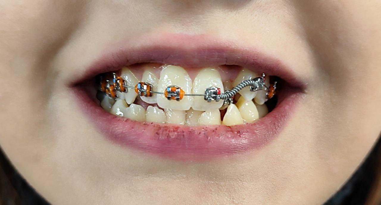 عکس دندانپزشکی الزهرا