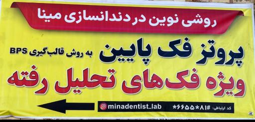 عکس دندانسازی مینا