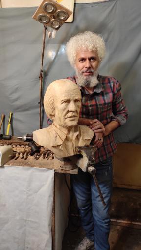 عکس منبت کاری جواد رحمتی مطلق 