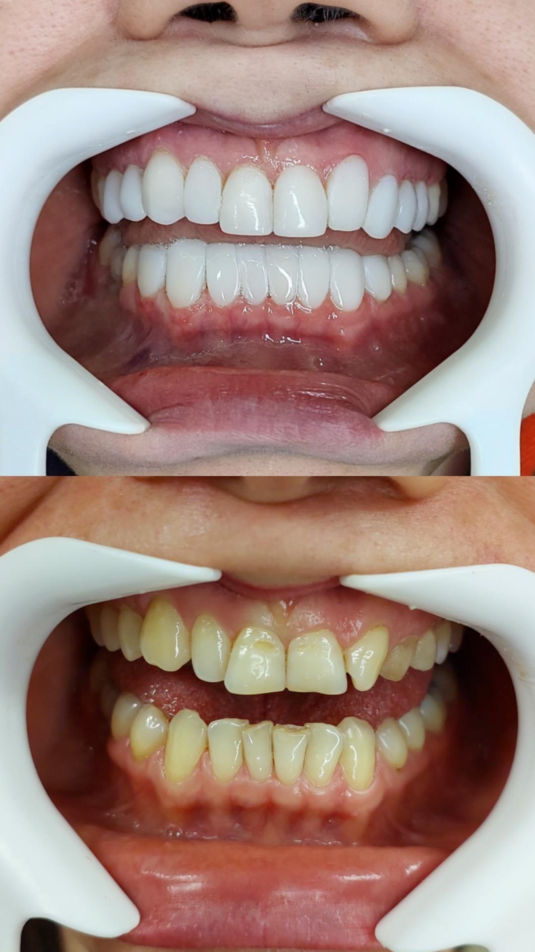 عکس دندانپزشکی الماس رودهن 