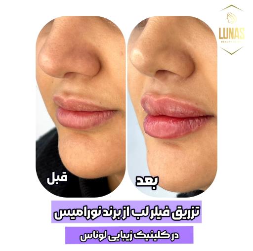 عکس کلینیک پوست مو و زیبایی لوناس