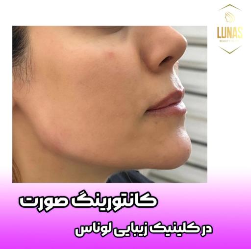 عکس کلینیک پوست مو و زیبایی لوناس
