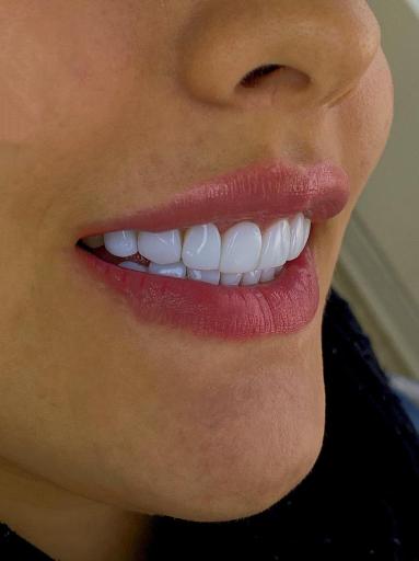 عکس دندانپزشکی صدف 