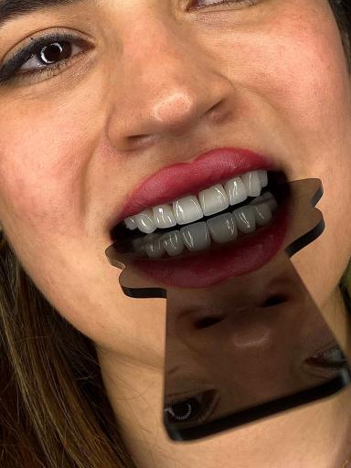 عکس دندانپزشکی صدف 