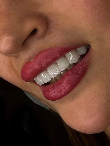 عکس دندانپزشکی صدف 