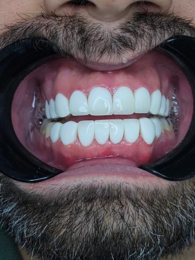 عکس دندانپزشکی صدف 