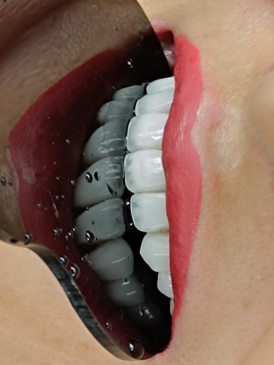 عکس دندانپزشکی صدف 