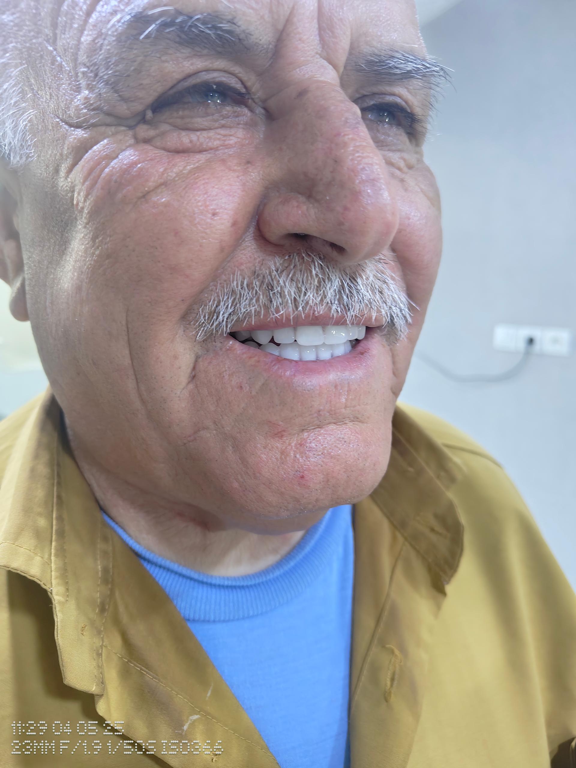 عکس دندانسازی پرستار 