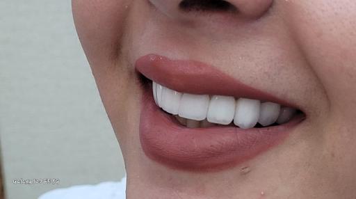 عکس دندانسازی رضاکیانی 