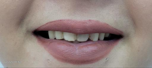 عکس دندانسازی رضاکیانی 