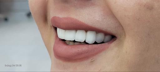 عکس دندانسازی رضاکیانی 