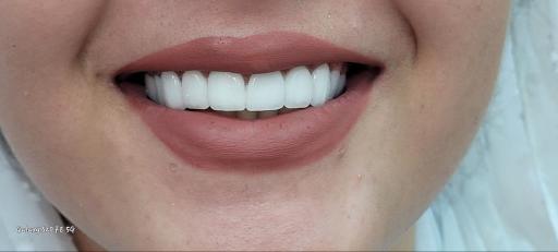 عکس دندانسازی رضاکیانی 