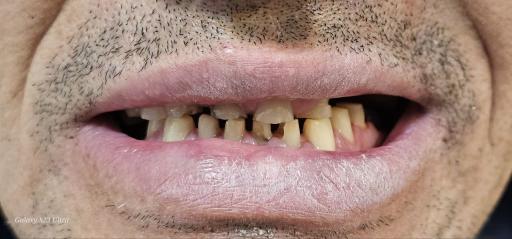 عکس دندانسازی رضاکیانی 