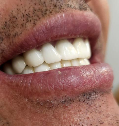 عکس دندانسازی رضاکیانی 