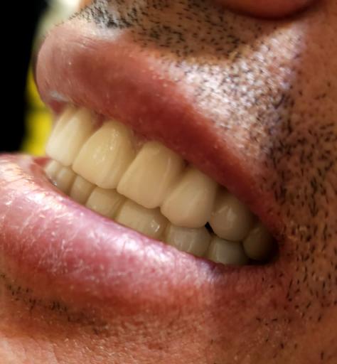 عکس دندانسازی رضاکیانی 